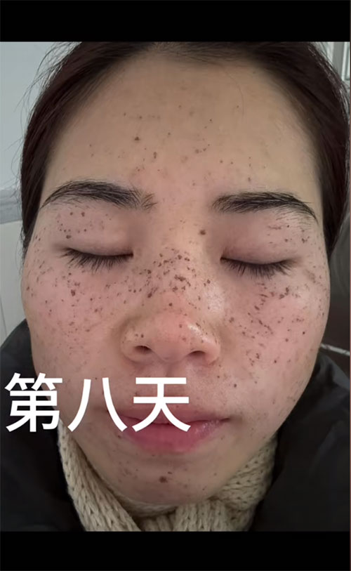 女性卖护肤品赛道，长期稳定私域玩法