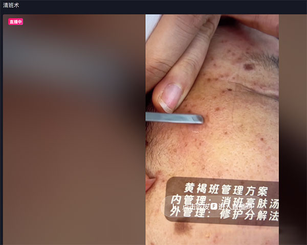 女性卖护肤品赛道，长期稳定私域玩法